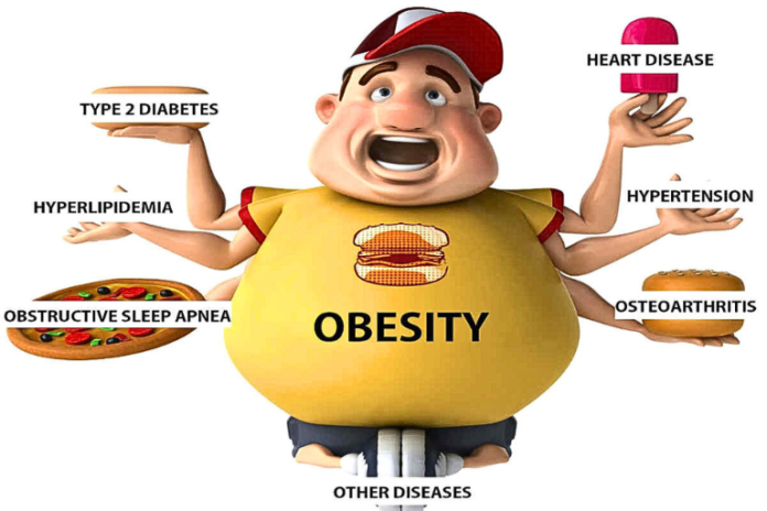 Obesity: Causes, Risks, and Effective Solutions for a Healthier Life