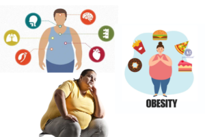 Obesity: Causes, Risks, and Effective Solutions for a Healthier Life