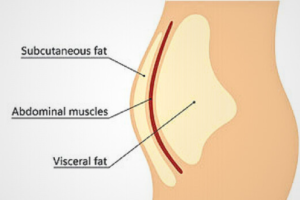 Why Women Gain Belly Fat: Causes, Types & Proven Solutions