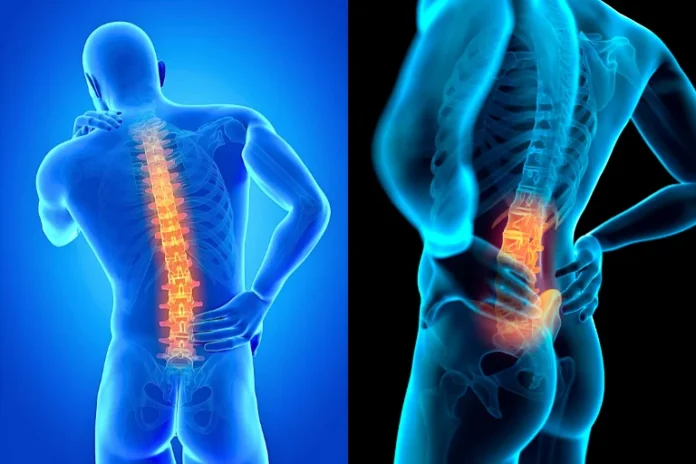 What Causes Back Pain? Symptoms, Treatments & Prevention Tips Explained