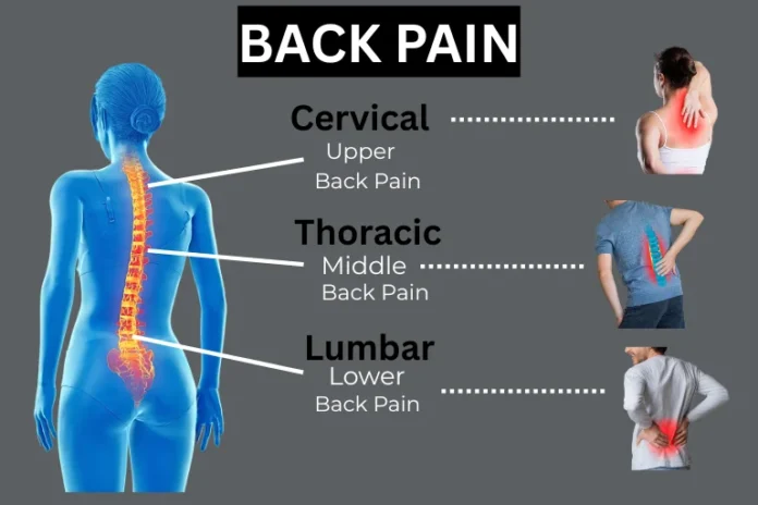 Upper, Middle, Lower Back Pain Explained: Causes, Symptoms & Treatments
