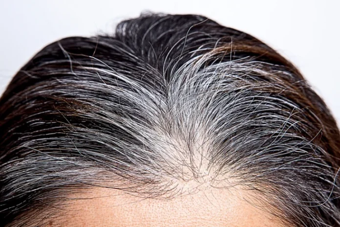 Premature White Hair: Complete Guide to Causes, Treatments & Prevention